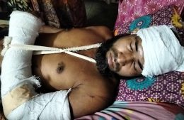 শেরপুরে বাড়ীর সীমানা বিরোধের জেরে ভাংচুর লুটপাটসহ হামলা : আহত-৫