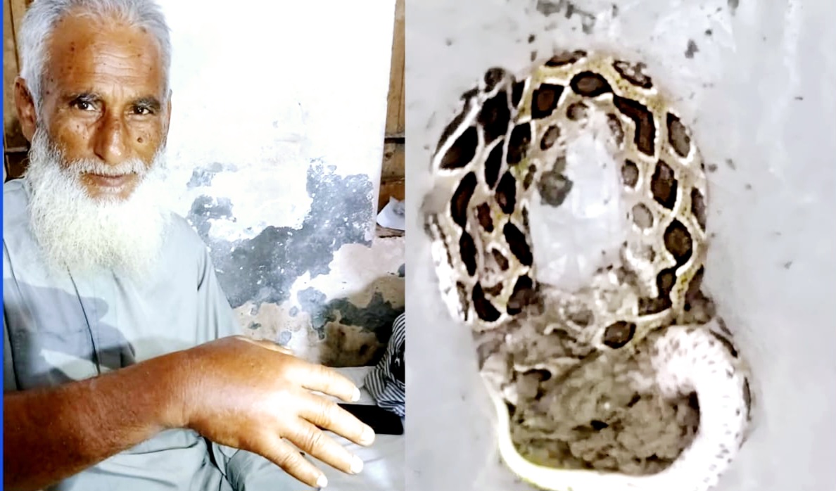 সখিপুরে রাসেল ভাইপারের কামড়ে আহত আজিজুল পাইক, হাসপাতালে সাপও